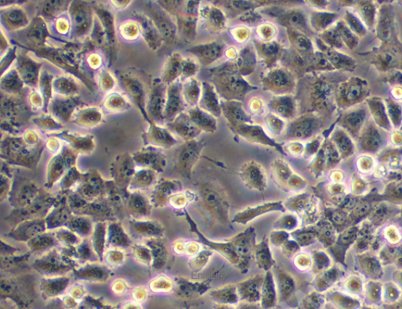 人胰腺癌细胞 PATU8988S（STR鉴定） | EnkiLife恩玑生命