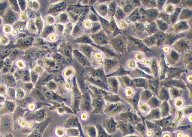 人胰腺癌细胞 PATU8988S（STR鉴定） | EnkiLife恩玑生命