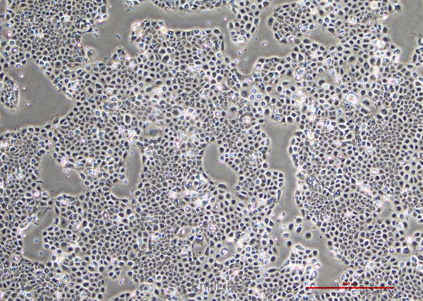 人原位胰腺腺癌细胞BxPC-3(STR鉴定) | EnkiLife恩玑生命