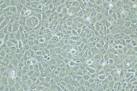 人整合SV40基因的乳腺上皮细胞HBL-100(STR鉴定) | EnkiLife恩玑生命