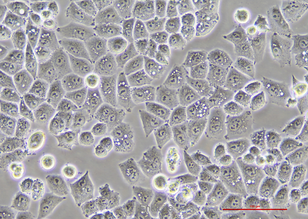 人正常卵巢上皮细胞IOSE-80(STR鉴定) | EnkiLife恩玑生命