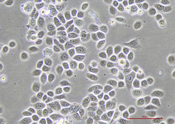 人支气管上皮细胞HBE135-E6E7(STR鉴定) | EnkiLife恩玑生命