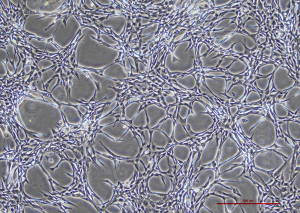 人脂肪干细胞永生化(免疫荧光鉴定) | EnkiLife恩玑生命