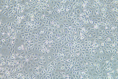 人子宫颈表皮癌细胞ME-180(STR鉴定) | EnkiLife恩玑生命