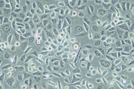 人子宫颈表皮癌细胞ME-180(STR鉴定) | EnkiLife恩玑生命