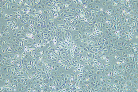 人子宫颈表皮癌细胞ME-180(STR鉴定) | EnkiLife恩玑生命