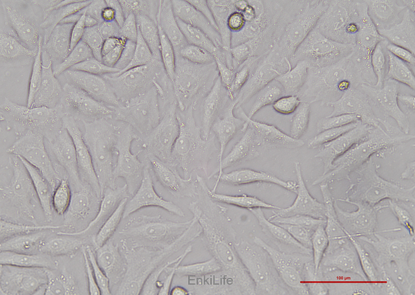 人子宫颈鳞癌细胞SiHa(STR鉴定) | EnkiLife恩玑生命