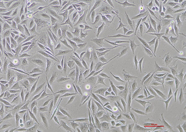 人子宫颈鳞癌细胞SiHa(STR鉴定) | EnkiLife恩玑生命