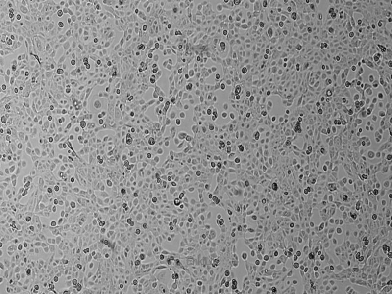 人子宫鳞癌细胞(高分化)HCC-94(STR鉴定) | EnkiLife恩玑生命