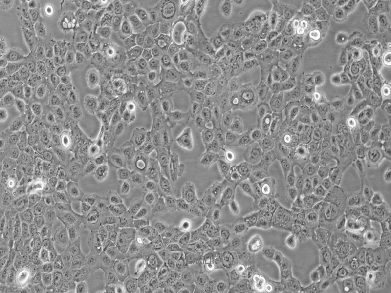 人子宫鳞癌细胞(高分化)HCC-94(STR鉴定) | EnkiLife恩玑生命