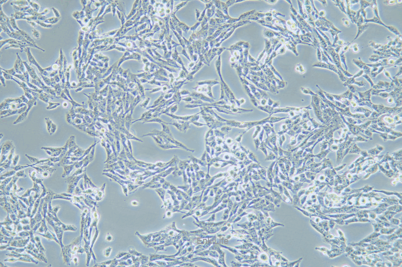 人子宫鳞状癌细胞SW756(STR鉴定) | EnkiLife恩玑生命