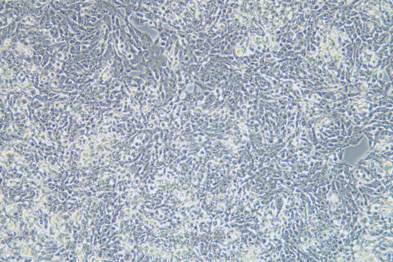 人子宫鳞状癌细胞SW756(STR鉴定) | EnkiLife恩玑生命