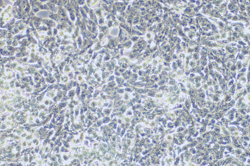 人子宫鳞状癌细胞SW756(STR鉴定) | EnkiLife恩玑生命
