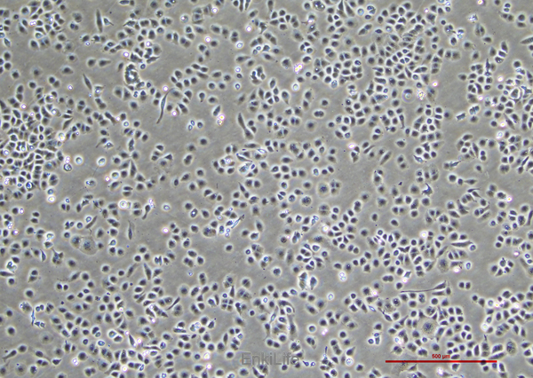 人子宫内膜腺癌细胞HEC-1-A(STR鉴定) | EnkiLife恩玑生命