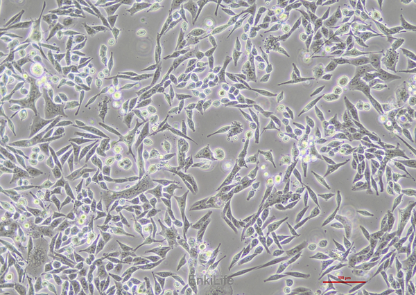 人子宫平滑肌肉瘤细胞SK-UT-1(STR鉴定) | EnkiLife恩玑生命