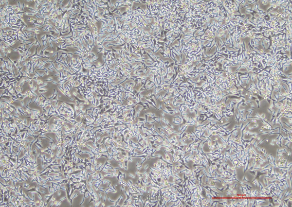 人子宫平滑肌肉瘤细胞SK-UT-1(STR鉴定) | EnkiLife恩玑生命