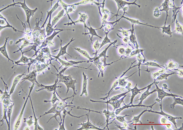 小鼠骨肉瘤成骨细胞K7M2 WT(STR鼠源鉴定) | EnkiLife恩玑生命