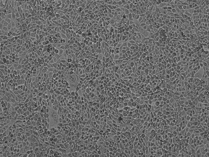 小鼠乳腺癌细胞EMT6(种属鉴定) | EnkiLife恩玑生命