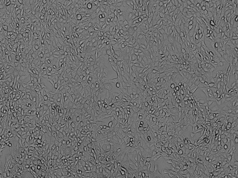 小鼠乳腺癌细胞EMT6(种属鉴定) | EnkiLife恩玑生命