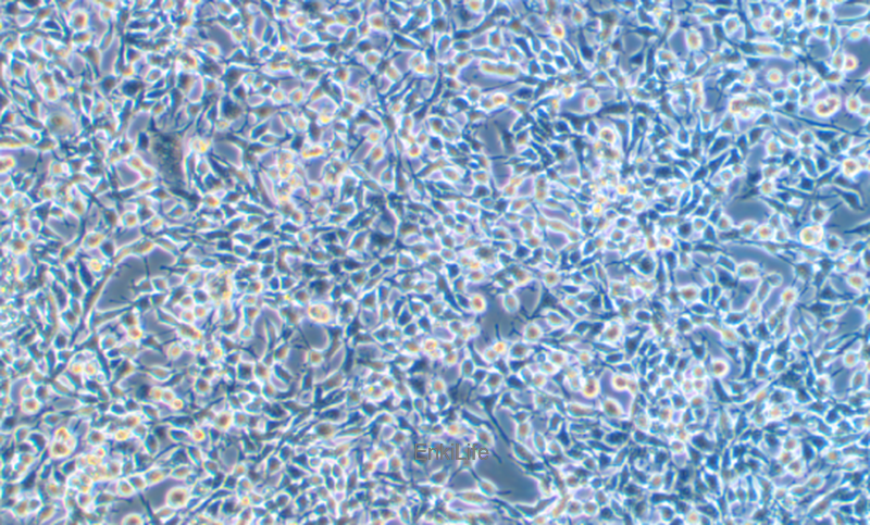 小鼠食管癌细胞AKR（种属鉴定） | EnkiLife恩玑生命