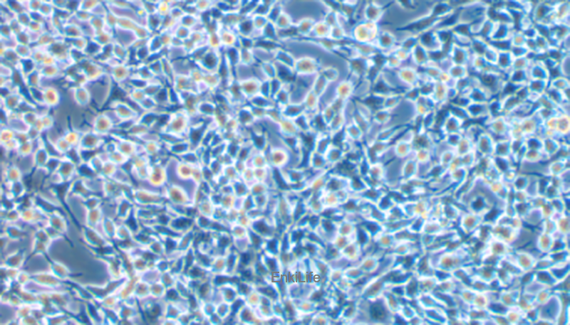 小鼠食管癌细胞AKR（种属鉴定） | EnkiLife恩玑生命