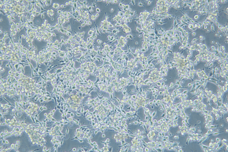 小鼠子宫颈癌细胞U14(种属鉴定) | EnkiLife恩玑生命