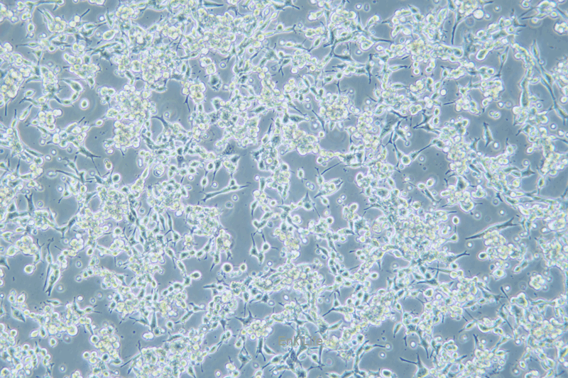 小鼠子宫颈癌细胞U14(种属鉴定) | EnkiLife恩玑生命