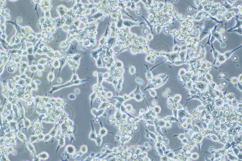 小鼠子宫颈癌细胞U14(种属鉴定) | EnkiLife恩玑生命
