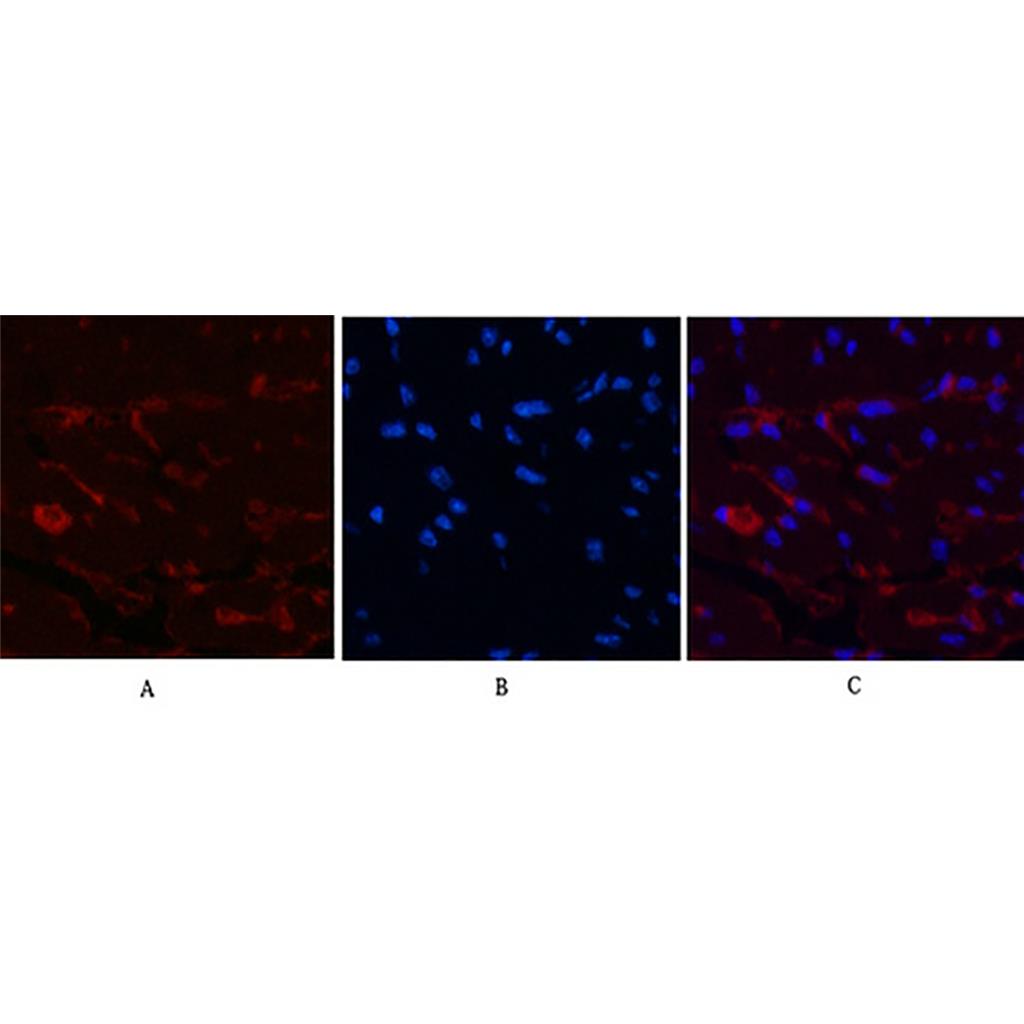 CD1a (4C3) Mouse Monoclonal Antibody | 鼠单抗 | EnkiLife恩玑生命