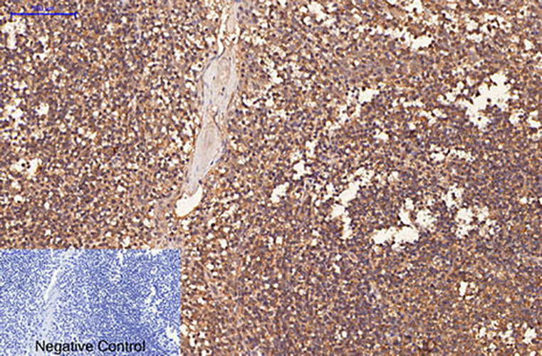 CD1a (4C3) Mouse Monoclonal Antibody | 鼠单抗 | EnkiLife恩玑生命