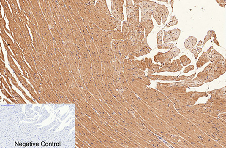 CD1a (4C3) Mouse Monoclonal Antibody | 鼠单抗 | EnkiLife恩玑生命