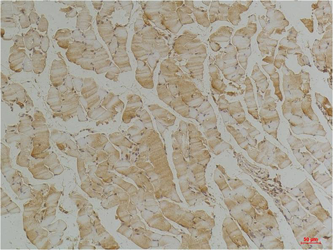 Desmin (4H1) Mouse Monoclonal Antibody | 鼠单抗 | EnkiLife恩玑生命