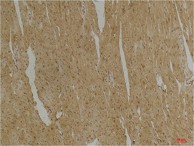 Desmin (4H1) Mouse Monoclonal Antibody | 鼠单抗 | EnkiLife恩玑生命