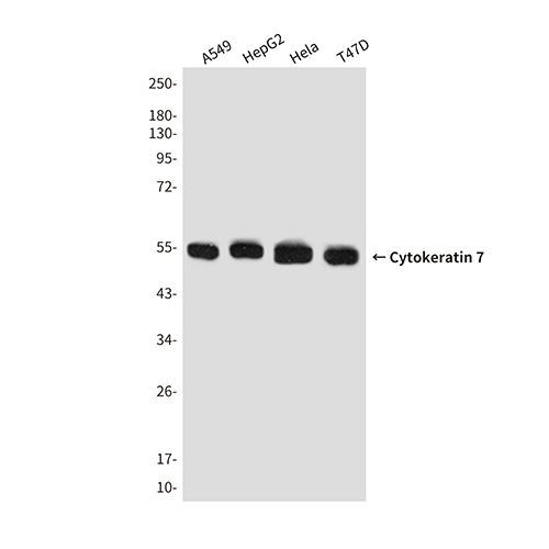 Cytokeratin 7 Mouse Monoclonal Antibody | 鼠单抗 | EnkiLife恩玑生命