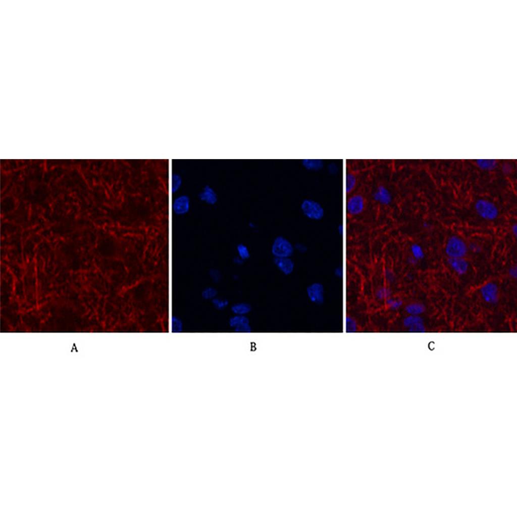 MAP2 (3B5) Mouse Monoclonal Antibody | 鼠单抗 | EnkiLife恩玑生命