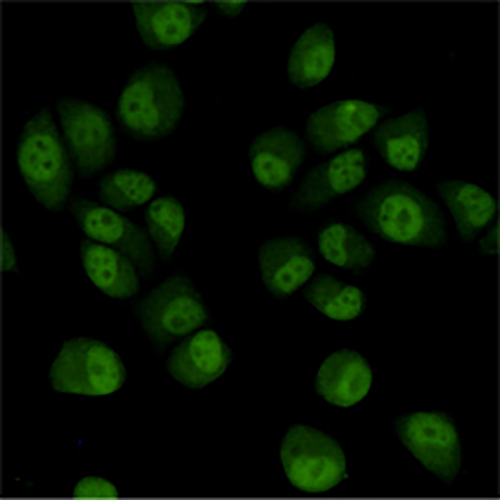 TBL1XR1 (4F3) Mouse Monoclonal Antibody | 鼠单抗 | EnkiLife恩玑生命