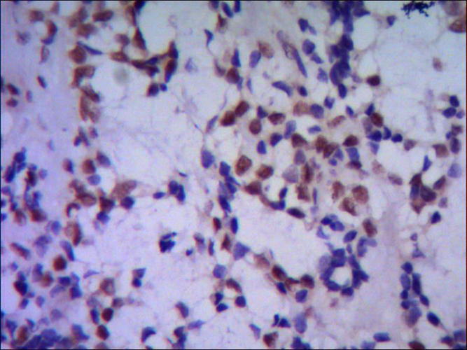 TBL1XR1 (4F3) Mouse Monoclonal Antibody | 鼠单抗 | EnkiLife恩玑生命