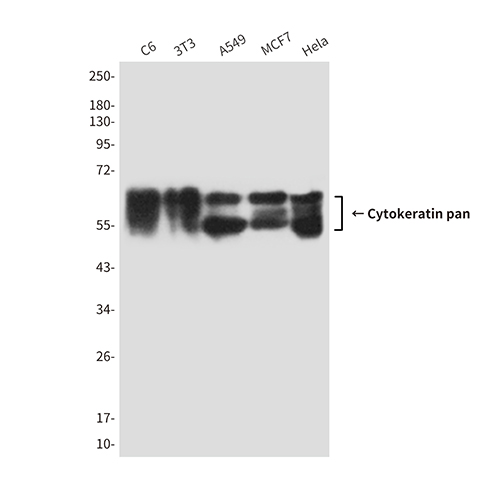 Cytokeratin pan (7H5) Mouse Monoclonal Antibody | 鼠单抗 | EnkiLife恩玑生命