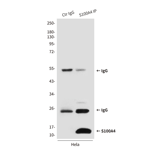 S100A4 (3D10) Mouse Monoclonal Antibody | 鼠单抗 | EnkiLife恩玑生命