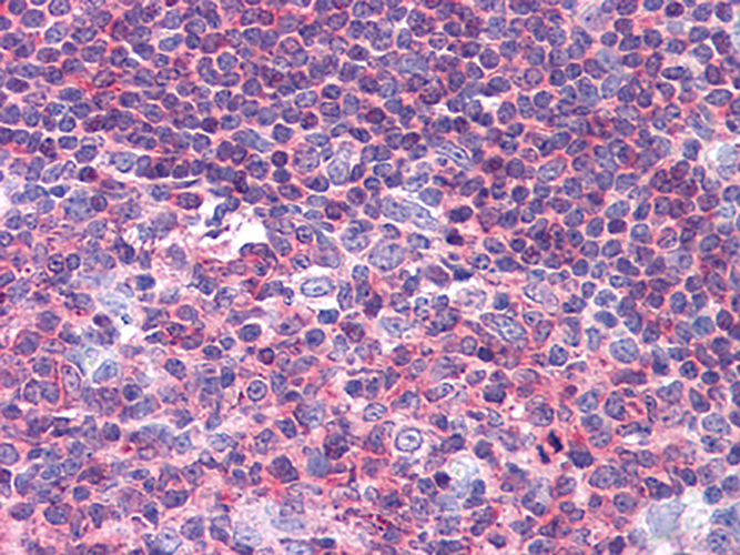 PYK2 (4B4) Mouse Monoclonal Antibody | 鼠单抗 | EnkiLife恩玑生命