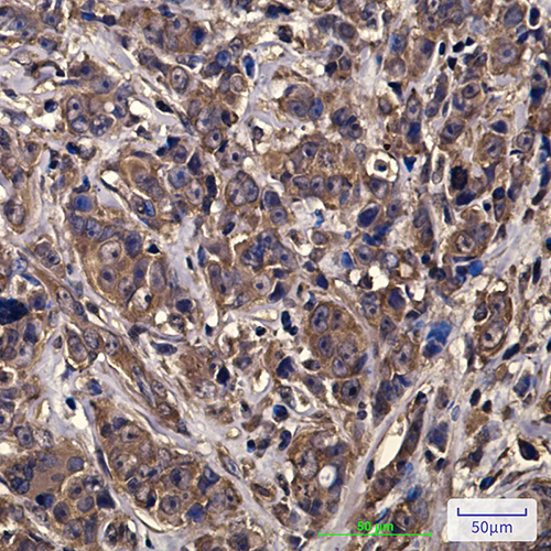 eIF4A1 (6D7) Mouse Monoclonal Antibody | 鼠单抗 | EnkiLife恩玑生命