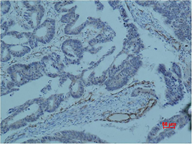 Survivin (8B9) Mouse Monoclonal Antibody | 鼠单抗 | EnkiLife恩玑生命