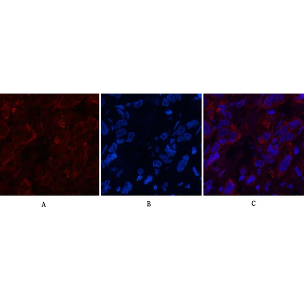 AFP alpha 1 Fetoprotein(17C5)Mouse Monoclonal Antibody | 鼠单抗 | EnkiLife恩玑生命