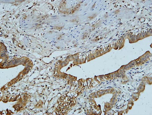 AFP alpha 1 Fetoprotein(17C5)Mouse Monoclonal Antibody | 鼠单抗 | EnkiLife恩玑生命