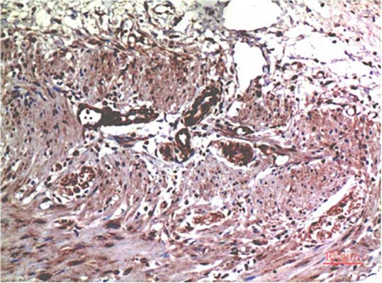 MMP2(1H1)Mouse Monoclonal Antibody | 鼠单抗 | EnkiLife恩玑生命