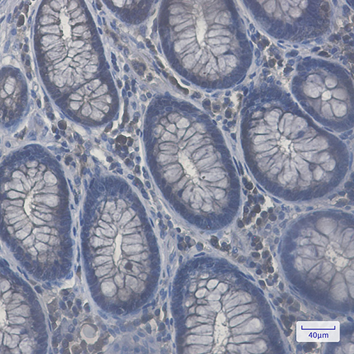 Rab8A Rabbit Monoclonal Antibody | 兔单抗 | EnkiLife恩玑生命