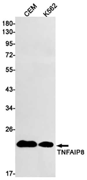 TNFAIP8 Rabbit Monoclonal Antibody | 兔单抗 | EnkiLife恩玑生命