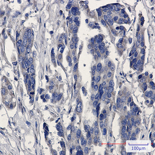 MGST1 Rabbit Monoclonal Antibody | 兔单抗 | EnkiLife恩玑生命