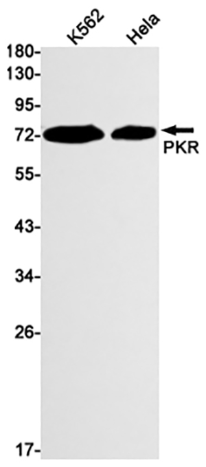 PKR Rabbit Monoclonal Antibody | 兔单抗 | EnkiLife恩玑生命