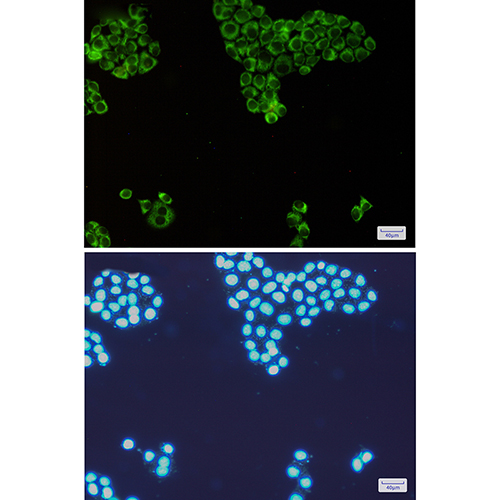 PKR Rabbit Monoclonal Antibody | 兔单抗 | EnkiLife恩玑生命